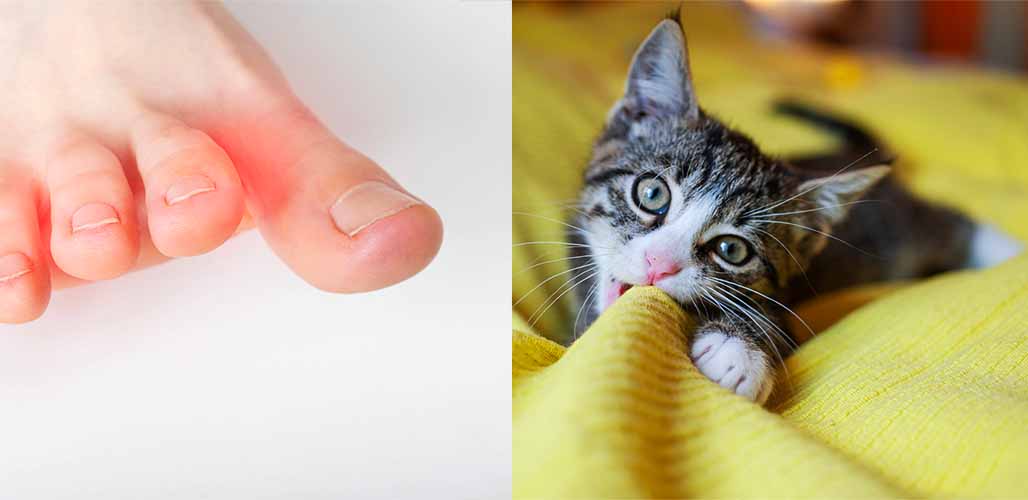 Pourquoi mon chat me mord-il les orteils ? - img